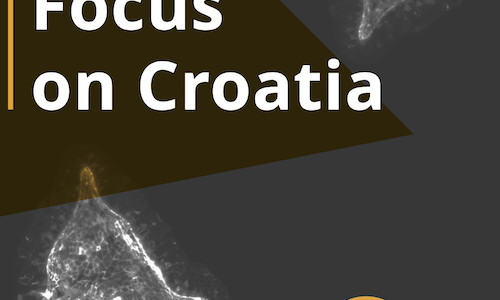 EMBO published a brochure “Focus on Croatia”. Happy reading!